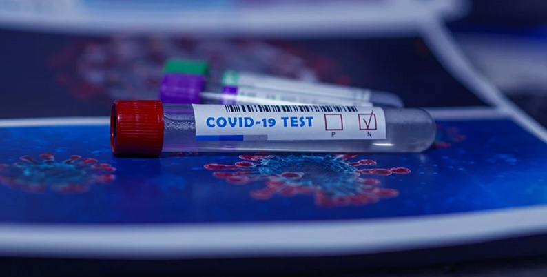 test_covid-02.jpg